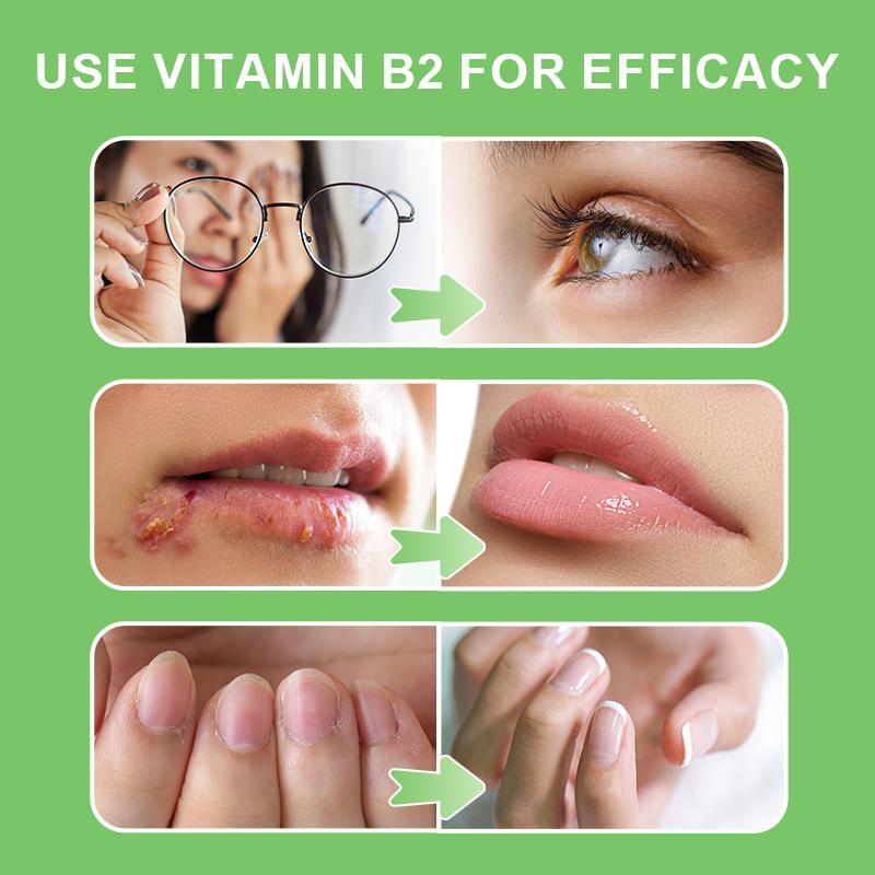 Bbeeaauu Vitamin B2 Riboflavin 300mg Supports Energy Production & Cellular Health Improve Vision and Reduce Eye Fatigue